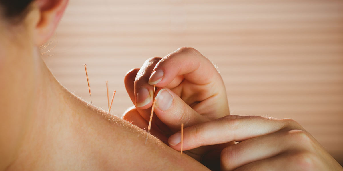 acupunture-news acupunture